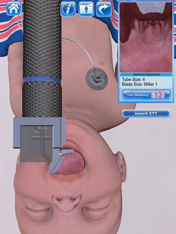 Infant Endotracheal Intubation screenshot-3