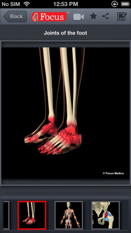 Atlas of Rheumatoid Arthritis screenshot-4