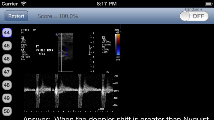 Radiology Physics 300 screenshot-3