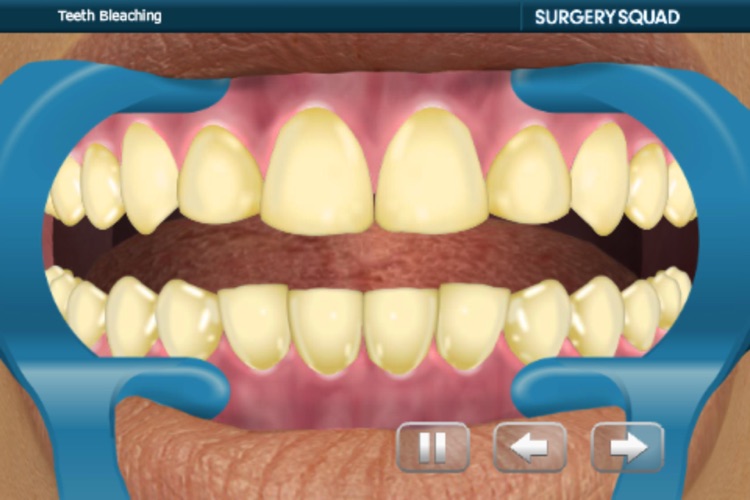 Virtual Teeth Whitening screenshot-4