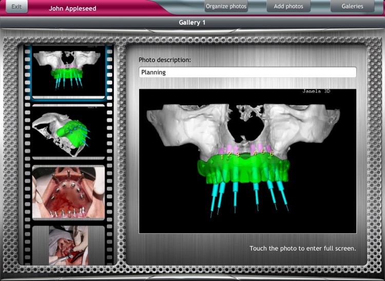 DentalChart Free screenshot-4