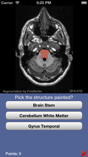 iSurf BrainView(圖4)-速報App