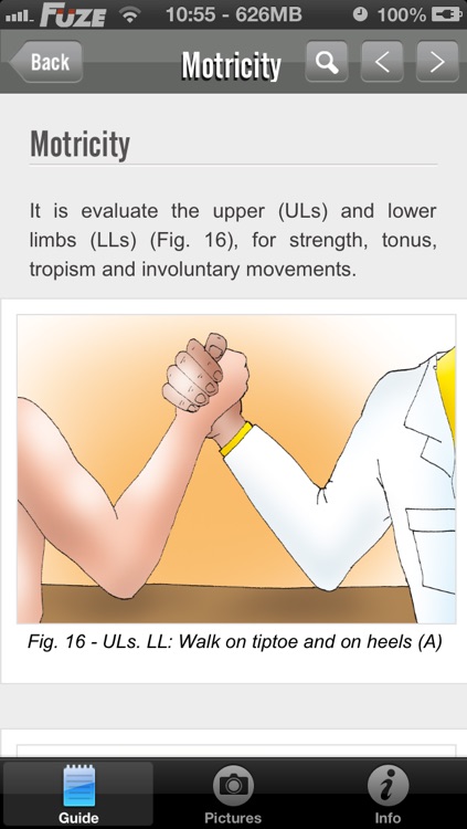 Neuro Exam