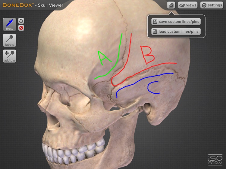BoneBox™ - Skull Viewer screenshot-4