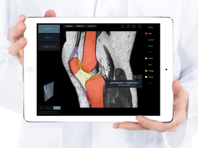 Radiology - Knee