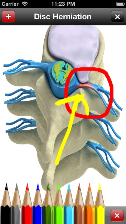 Med Sketch: Anatomy Drawing App