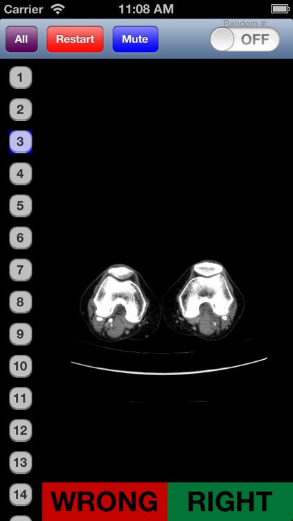 General Radiology 2