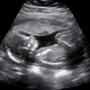 Baby Ultrasound 2015 - Ogtus Media LLC