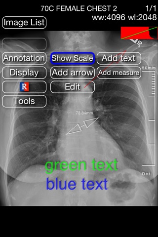 iMedViewer screenshot 3