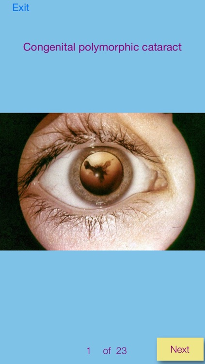 Ophthalmic Pathology