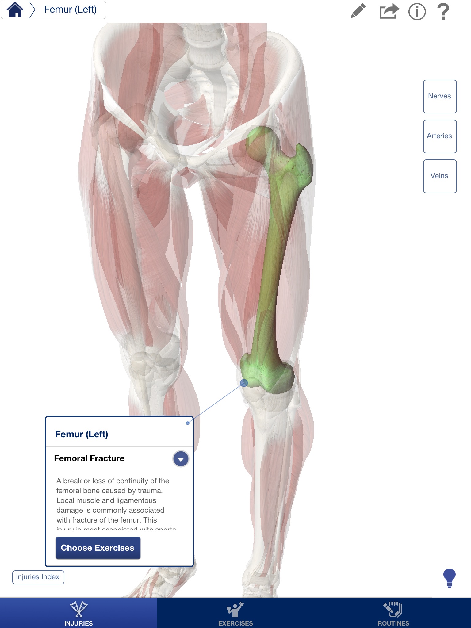 Rehabilitation for Lower Limbs screenshot 3