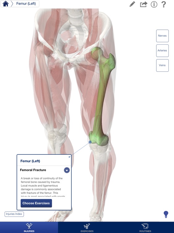 Rehabilitation for Lower Limbs screenshot-2