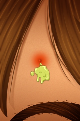 Pimple Popping Game - Free screenshot 3