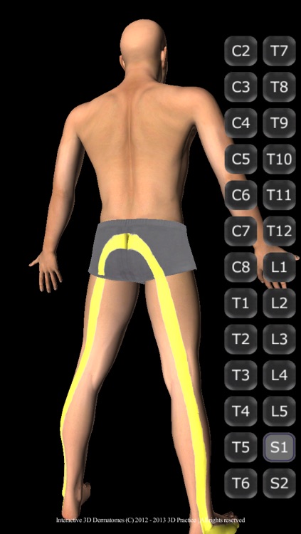 Interactive 3D Dermatomes