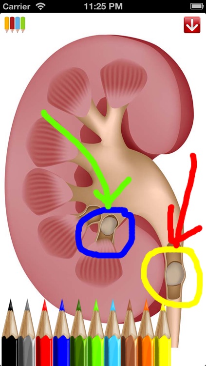 Med Sketch: Anatomy Drawing App screenshot-3