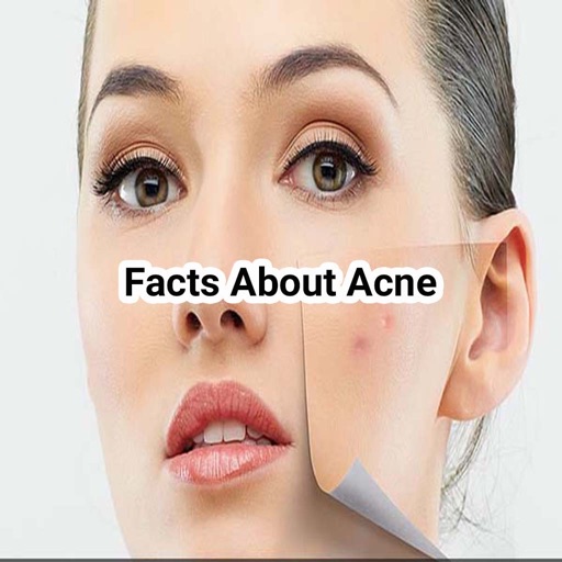 About Acne icon