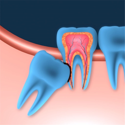 Wisdom Teeth 101:Guide  and Health Tips,Oral Pathology,Dental Hygienist icon