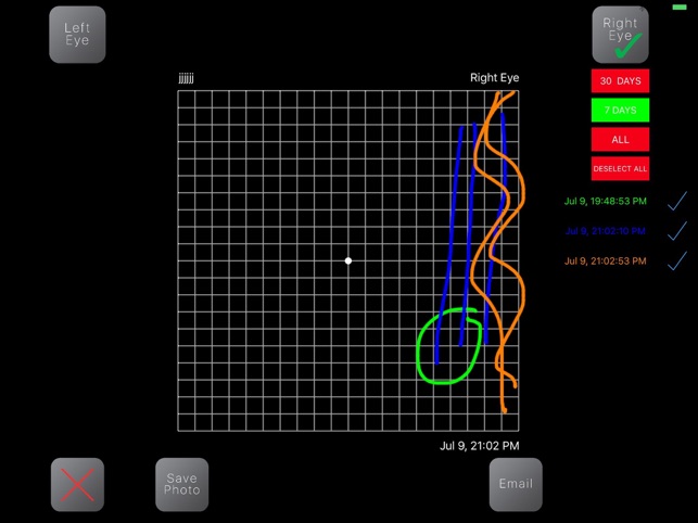 Amsler 3D(圖2)-速報App