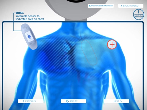 SEEQ MCT Patient Education screenshot 2