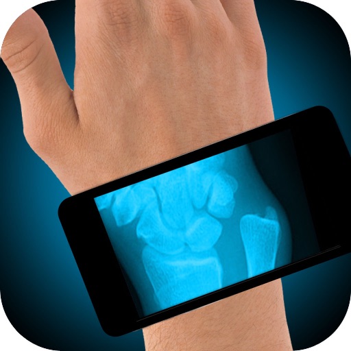 Simulator X-Ray Hand Fracture Icon