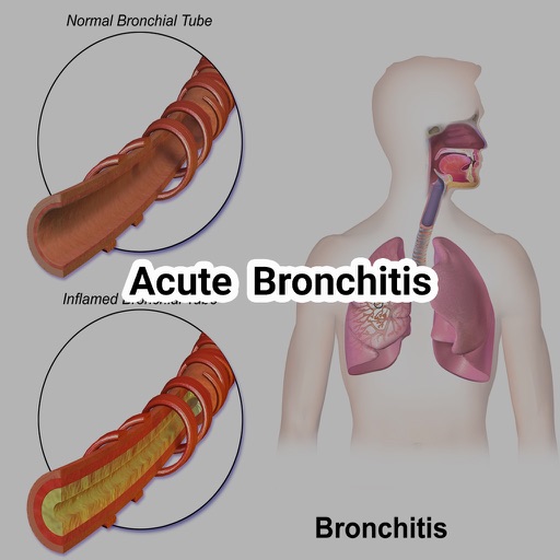 Acute Asthamatic Bronchitis Prevention,Cure and Complete Health App icon