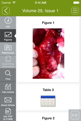 Clinical Transplantation screenshot 2