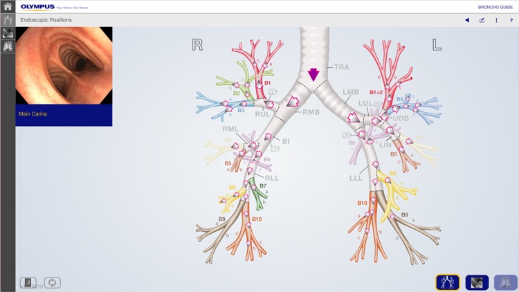 BronchoGuide