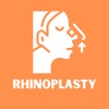 Rhinoplasty Cost & Info