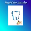 Teeth Color Matching