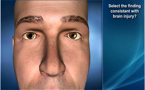 Medrills: Skull and Brain Injuries screenshot 4