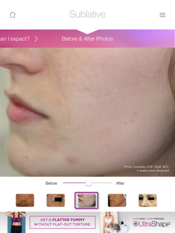 Syneron Candela Patient Consultation App screenshot 2