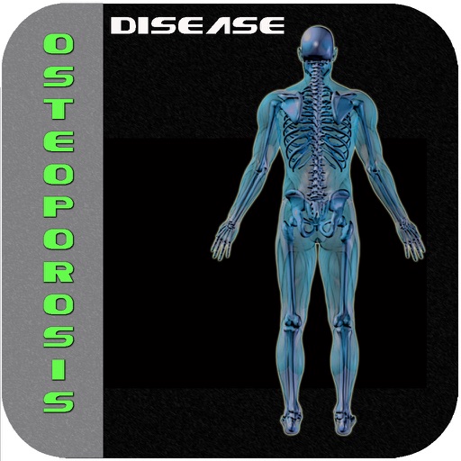 Osteoporosis Disease V1