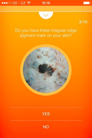 Melanoma Test - risk calculator of skin cancer - náhled