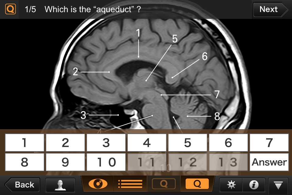 Interactive CT and MRI Anatomy screenshot 4