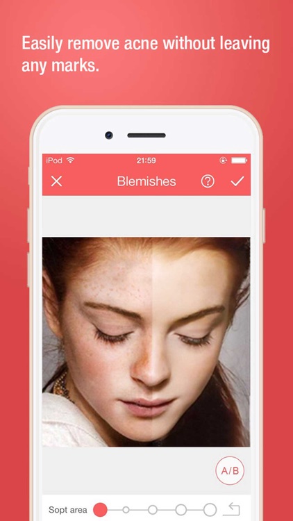 Beautify Cam-remove your face acne and blemish