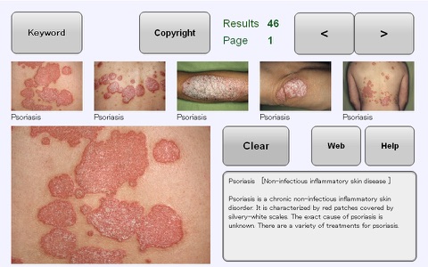 YSP Dermatology Image Database for iPhone screenshot 2