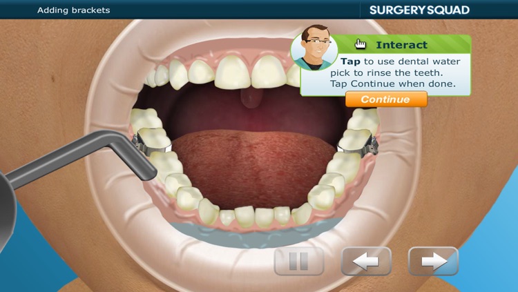Virtual Braces