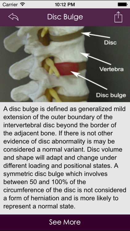Spine Conditions & Treatment