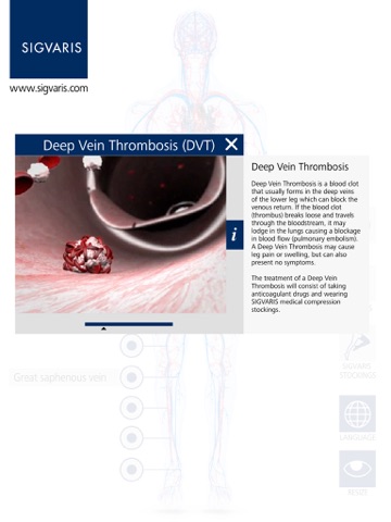 SIGVARIS GROUP Vein App screenshot 2