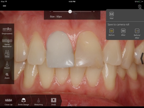 SmileHD screenshot 3