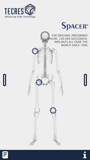 Tecres(圖2)-速報App