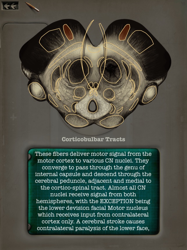 Brainstem101 - Neuroanatomy of the Human Brainstem(圖5)-速報App