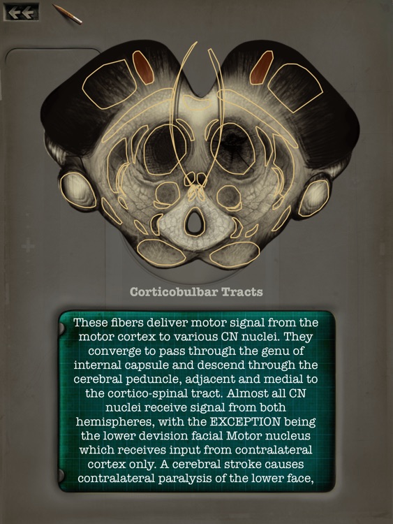 Brainstem101 - Neuroanatomy of the Human Brainstem screenshot-4