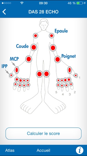 SCORES ECHO : Scoring échographique dans la polyarthrite rhu(圖3)-速報App