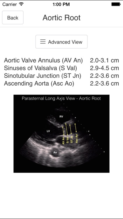 Pocket Emergency Ultrasound screenshot-3