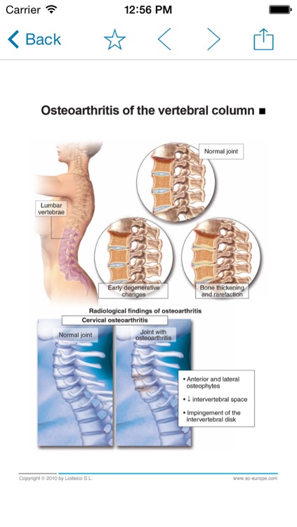 Miniatlas Diseases of the vertebral column screenshot-4