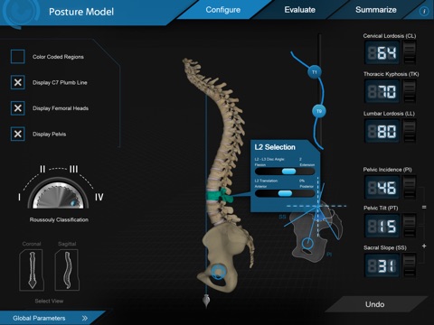 CATALYST™ Spino-Pelvic Posture Simulation screenshot 2