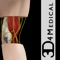 Elbow Pro III gives users an in depth look at the elbow, allowing them to cut, zoom & rotate the elbow