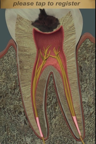 Dental Pain Lite screenshot 3