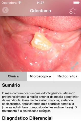 Oral Lesions screenshot 2